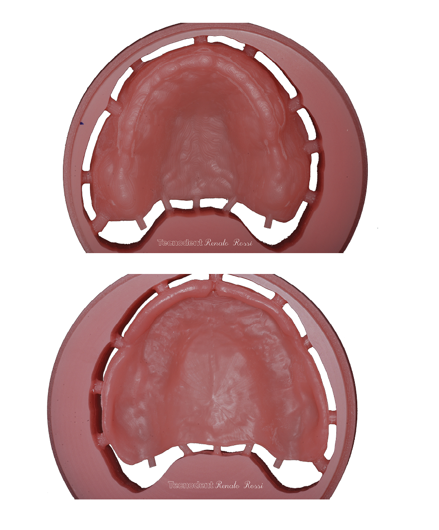 Protesic disk